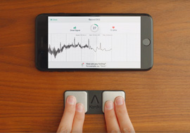 KardiaMobile: Frequently Asked Questions about Mobile EKG Monitors